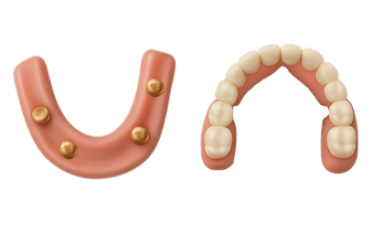 Precio sobredentadura con 4 implantes dentales