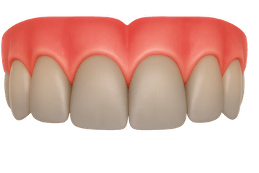 Dientes opacos o apagados