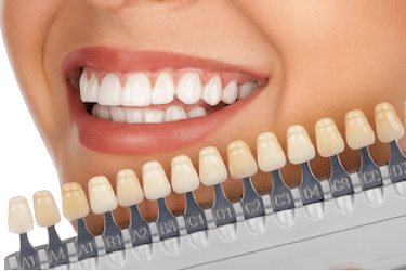 Especialistas en estética odontológica