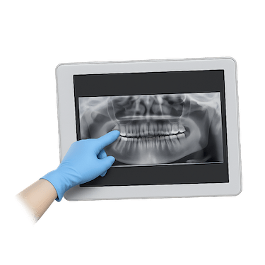 Exploración inicial