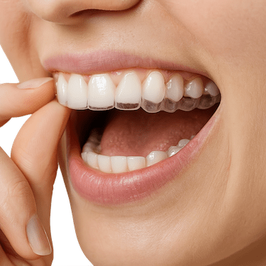 Alineadores invisibles