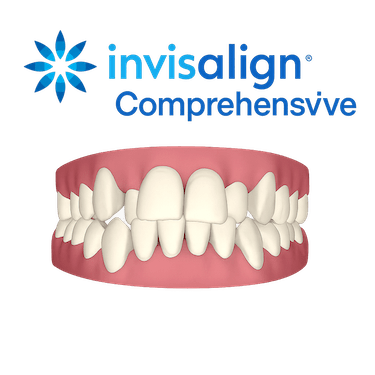 Invisalign Full Comprehensive