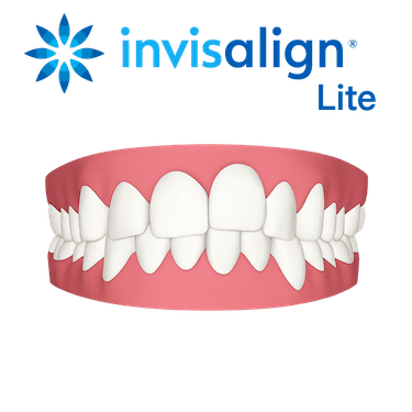 Invisalign Lite