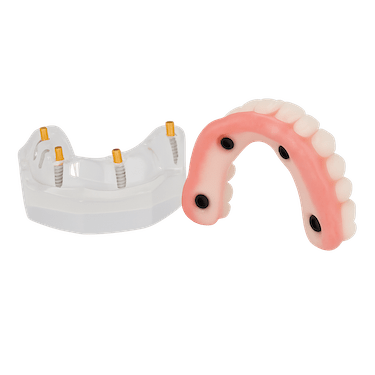 Carga inmediata con All-on-4