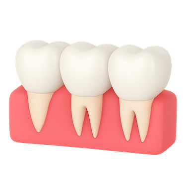 Colocación de la corona definitiva