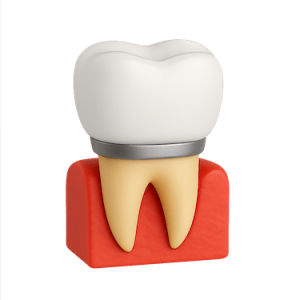 Corona metal porcelana