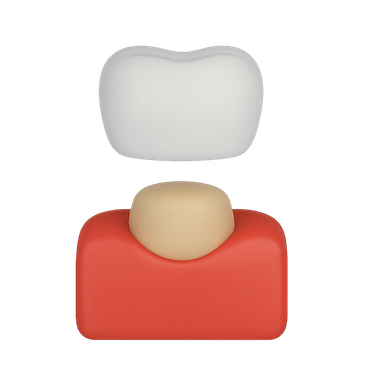 Colocación de corona provisional