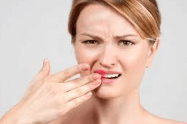 diente roto por golpe diente roto