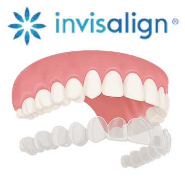 ¿Qué es Invisalign?