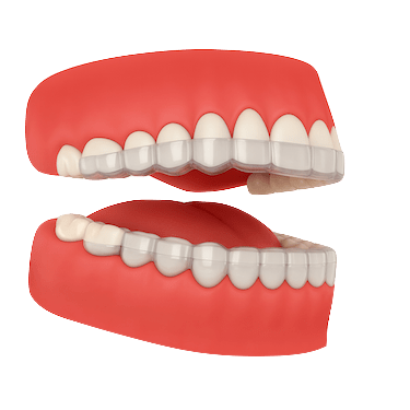 ¿Qué es una férula de descarga?