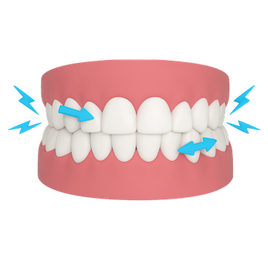 Bruxismo excéntrico