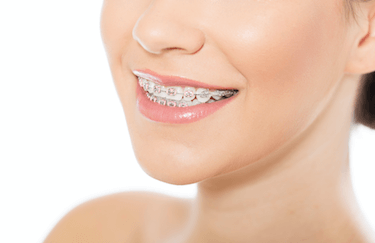 recomendaciones de higiene dental con ortodoncia enjuages higiene dental brackets
