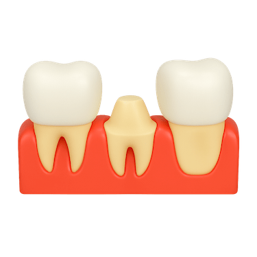 Preparación del diente y tallado dental