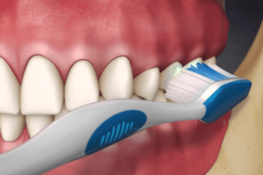 tecnica de cepillado adecuada tecnica correcta cepillado