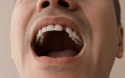 Estética dental visiblemente afectada