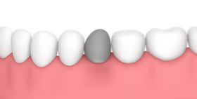 Traumatismos dentales
