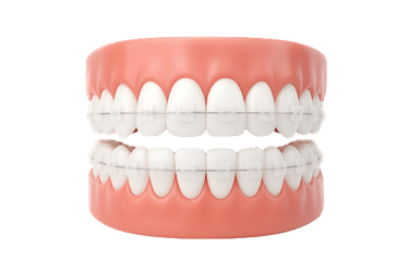 Ortodoncia estética