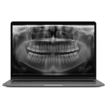 Valoración y diagnóstico: cómo saber si necesitas una endodoncia