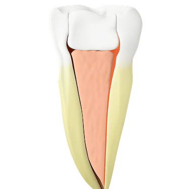 Reconstrucción del diente: empaste o corona tras la endodoncia