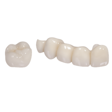 Corona sobre implante