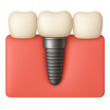 Implante dental unitario