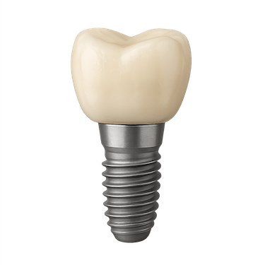Corona sobre implante