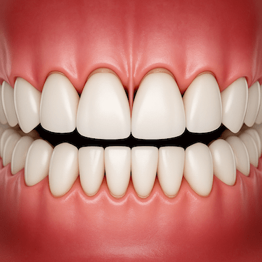 ¿Qué es la Periodoncia?