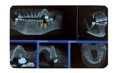 Especialistas en carga inmediata