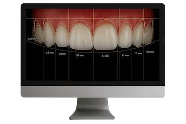 Diseño digital de la sonrisa