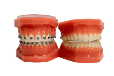 ¿Qué ortodoncia es la más efectiva?