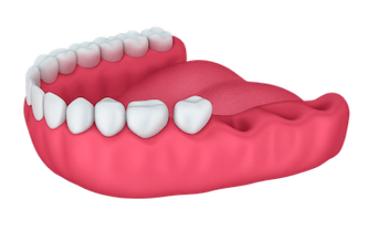 Pérdida de varios dientes seguidos