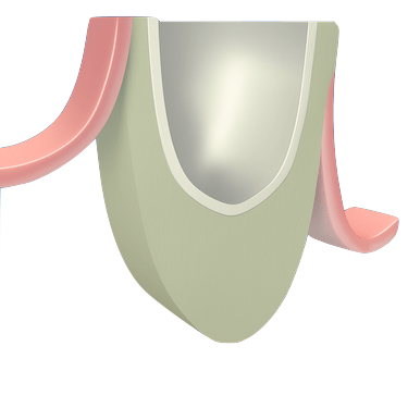Acceso quirúrgico al seno maxilar
