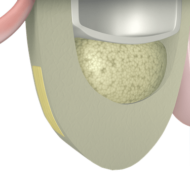 Cierre de la ventana lateral con membrana