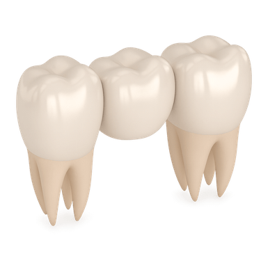Colocación del puente provisional