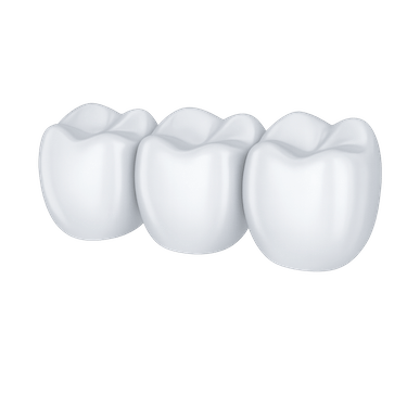 Diseño y colocación del puente definitivo