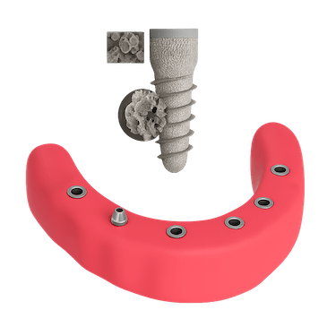 Integración de los implantes en el hueso