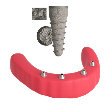 Fase de osteointegración