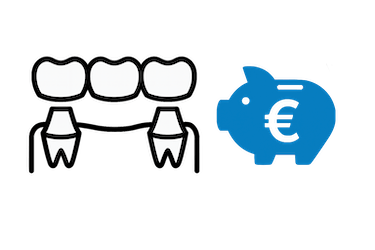 Precio de un puente dental en Murcia