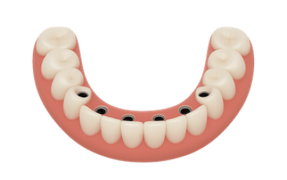 ¿Buscas una dentadura que no se mueva y se adapte a ti?