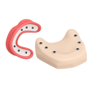 Diseño y fabricación de la prótesis dental híbrida