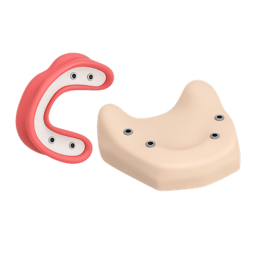 Toma de impresiones y diseño de la sobredentadura