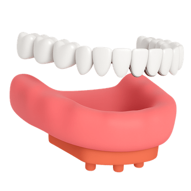 Confección de la estructura definitiva: coronas o puentes cerámicos