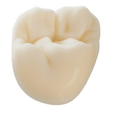Corona de disilicato de litio sobre implante
