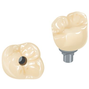 Corona de zirconio sobre implante