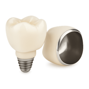 Corona metal cerámica sobre implante