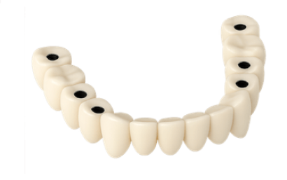 Protesis dental fija en Murcia