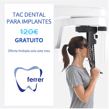 TAC dental incluido sin coste este mes