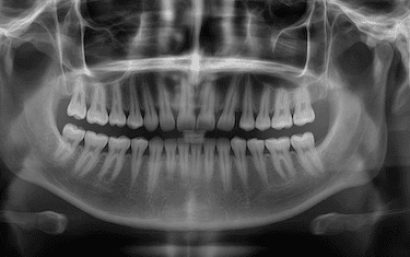 Envíanos tu radiografía